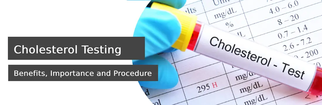 Cholesterol Testing: Benefits, Importance, Procedure, Cost